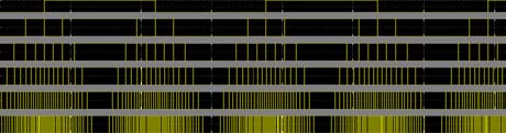 a) Static Case Simulations (Without application of Incident Radiation) i. Silicon Drift Detector The 2D cross-section of the SDD-JFET system [Fig. 1(b)] has been used as input to run a static case current voltage simulation. The 2D cross-section in figure 1(b) has been subjected to application of appropriate voltages and suitable boundary conditions were added to ensure that the solution to the poisson & continuity equations would converge. The biases were applied such that the anode was at a zero potential, ear 2012 Y Global Journal of Researches in Engineering Volume XII Issue v v Journals Inc. (US) A First Principle's Approach to Study of the Silicon Drift Detector with embedded JFET: Noise Analysis, d) Equivalent Noise Charge due to JFET drain shot noise This component can be minimized by having a small value for capacitances together with a high g m . ---Eq. 4 Simulations & Analytical Modeling cathode-1 was given -5 volts potential and cathode-20 at -100 V. The intermediate cathodes got biased through the on-chip poly-resistor network. This peculiar biasing develops a potential distribution resembling a gutter (Ref. 4). The one dimensional potential along the depth is parabolic in nature. This leads to confinement of electrons generated by photo-electric absorption of incident photons. The photoelectrons are first concentrated within the minima along the depth and then drifted along the horizontal channel towards the anode where they ultimately get collected. The above biasing scheme results in an electric field of 370 V/cm. Corresponding to the field strength & an Electron Mobility of 1350 cm 2 / V.s at 300 o K, Electron Drift Velocity works out to be 5 × 10 5 cm/s. This implies a detector response time (Drift Time) of around 100 nano seconds for a drift distance of around ~500 µm. Value of resistance of poly-resistor was fixed at 100 k? for W = 120 µm & L = 80 µm, which corresponds to a total resistor chain current of around 65 µA under these biasing conditions. The simulated detector anode (output) capacitance at full depletion is around 200 femto Farad which is flexible enough to play with and tune with the integrated transistor's capacitance.