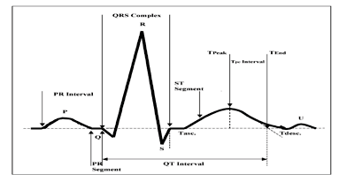Figure 2 : Regular ECG Waveform, Bradycardia & Tachycardia respectively