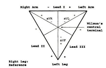 Figure 4 : Three level wavelet (a) decomposition and (b) reconstruction tree V. METHODOLOGY The process of analyzing ECG signal can be divided into two stages: preprocessing and the feature extraction. QRS spike is to be detected first and then P, T & other derivatives will come automatically. The algorithm of the proposed analysis technique is as follows: S Step1 : De-trending / removal of baseline wandering from the raw ECG waveform Step 2 : De-noising/ removal of wideband noise from the de-trended ECG signal Step 3 : Implementation of FFT and IFFT pair for further noise reduction Step 4: Detection of QRS Complex Step 5 : P and T wave detection Preprocessing means removing cardio noise from the same frequency band caused by electromyographical potentials of muscles, motion artifacts or background noise source. It leads to compression and the smoothing of the ECG signal. The stage of feature extraction from the cardio signal includes the process of finding the required information like the teeth, complex etc. The details of the methodology are: a) Preprocessing i. De-trending / Removal of Baseline Wandering