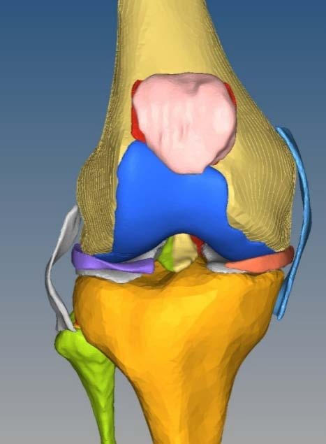 Figure 1: Sketch of three dimensional finite element model of entire knee