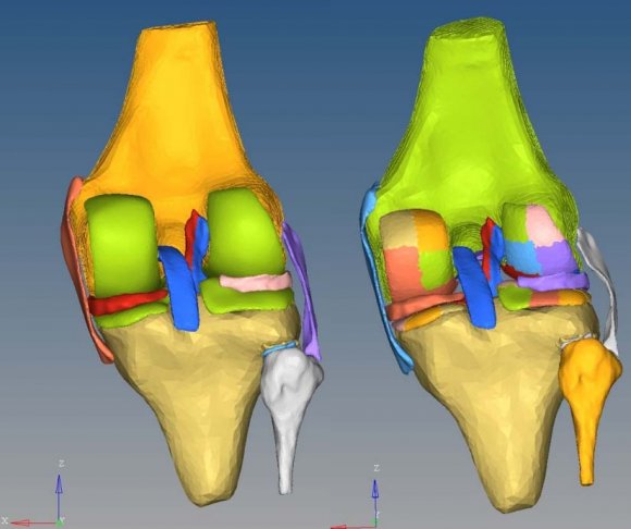 Figure 2a: Comparison of homogeneous cartilage (left) and heterogeneous cartilage (right) partition