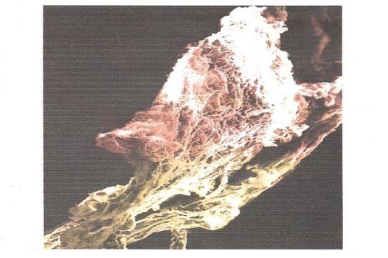 Journal of Researches in Engineering ( ) Volume Xx XI Is sue II Version I J Gl 12 Year 2 021 Ecology and Greenfield Precincts: Integrating Conservation and Bushfire Exposure Risk into Urban Planning © 2021 Global Journals Growling Grass Frog Models (1) Current greenfield landscape scenario (No change in buffer zone width) (2) PSP Buffer zone scenario (variable between 50m -200m) (3) 50m Buffer zone scenario (4) 200m Buffer zone scenario